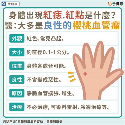 紅色的痣代表什麼|皮膚長「紅痣」會怎樣？跟黑痣有何不同？會是皮膚癌。